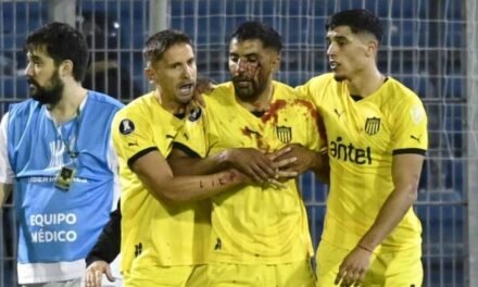 Maxi Oliveira recibe una pedrada en el rostro de un aficionado de Rosario Central