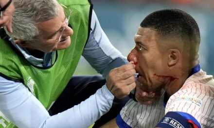 Mbappé sufre fractura de nariz y será operado en Dusseldorf